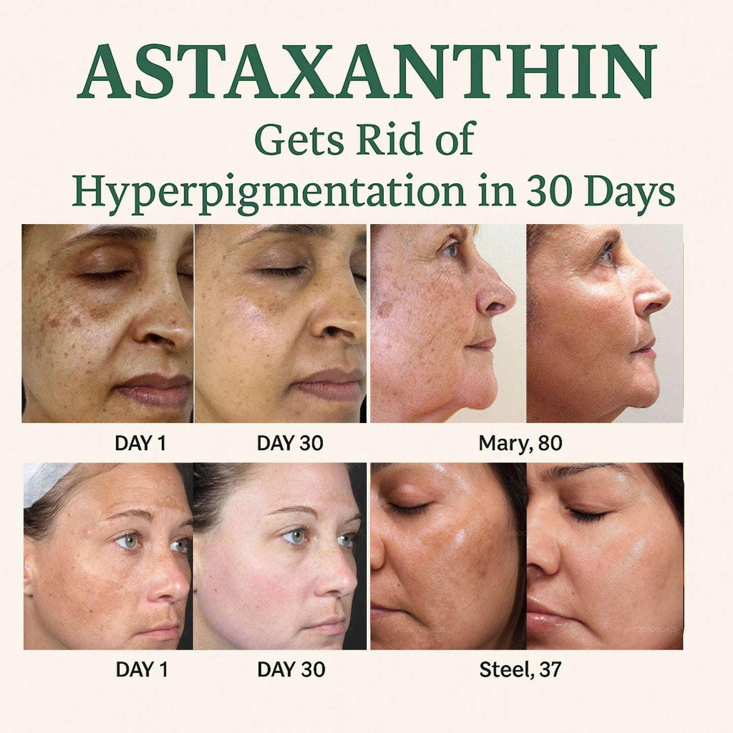Astaxanthin Softgels